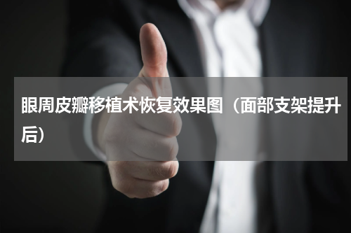 眼周皮瓣移植术恢复效果图（面部支架提升后）