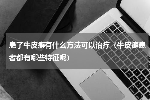 患了牛皮癣有什么方法可以治疗（牛皮癣患者都有哪些特征呢）