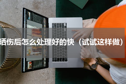 晒伤后怎么处理好的快（试试这样做）