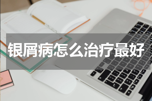 银屑病怎么治疗最好